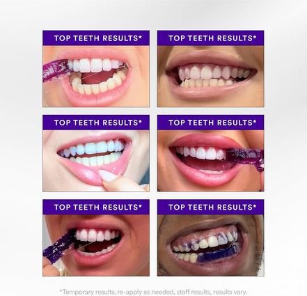 Hismile V34 Teeth Whitening Strips
