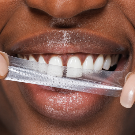 PAP+ Teeth Whitening Strips